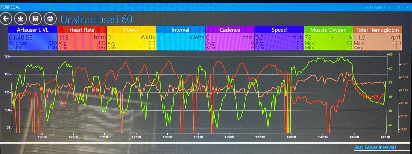 Exerfly Moxy Monitor